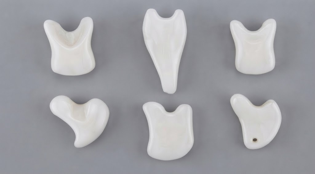 Injection moulded ceramic components